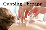 Cupping Therapy being performed.